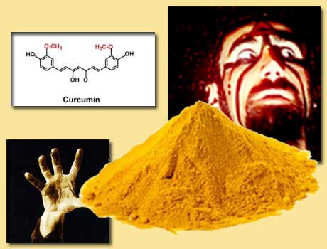 Curcumin, hội chứng Down, chứng Down, curcumin, Alzheimer, trí nhớ, tinh bột nghệ, nghệ vàng