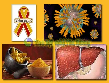 Tinh bột nghệ, Viêm gan C, viêm gan, virus, bột nghệ, nghệ vàng, virus viêm gan C, tinh bot nghe, bot nghe, nghe vang