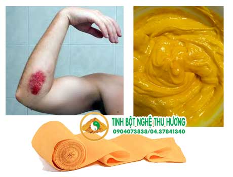 Chua lanh vet thuong voi nghe vang nhu the nao