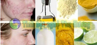 Nám da và kinh nghiệm trị nám da với tinh bột nghệ vàng