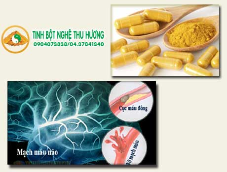 Đột quỵ, nghệ vàng, tế bào não, curcumin, tế bào thần kinh, thần kinh