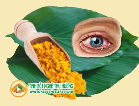 Viêm màng bồ đào, nghệ vàng, màng bồ đào, curcumin, chống oxy hóa, mắt, tinh bột nghệ, Meriva