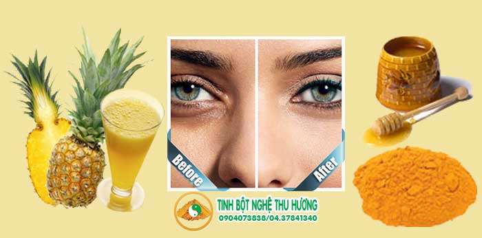 Mắt thâm quầng, quầng thâm, thâm quầng, tinh bột nghệ, nghệ vàng, bột nghệ, mỹ phẩm