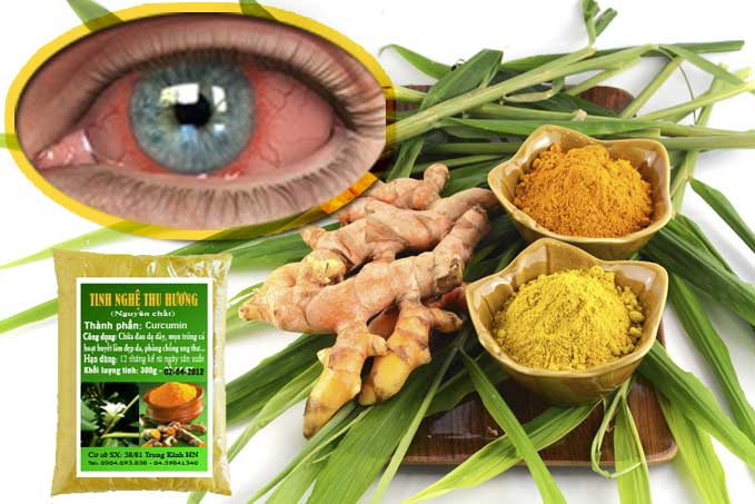 Viêm màng bồ đào, bệnh viêm màng bồ đào, màng mạch, viêm nhiễm, tinh bột nghệ, bột nghệ, nghệ vàng, tinh bot nghe, bot nghe, nghe vang