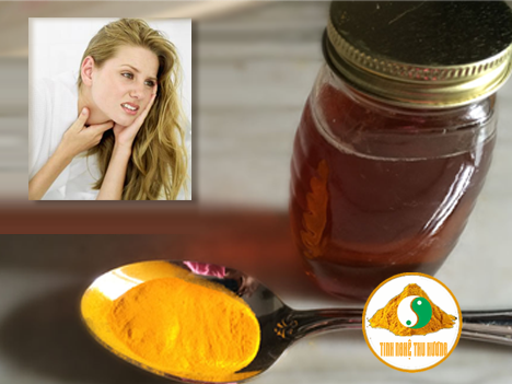 Cách chữa viêm họng, viêm họng, tinh bột nghệ, bột nghệ, nghệ vàng, mật ong, nước muối, sữa nghệ, cach chua viem hong, viem hong, tinh bot nghe, bot nghe, nghe vang, sua nghe