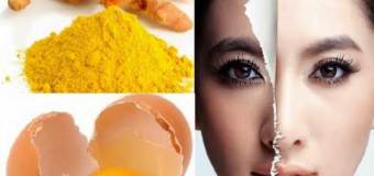 Cách trị nám da mặt hiệu quả với tinh bột nghệ vàng