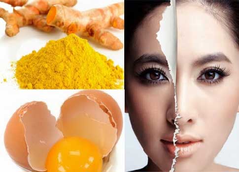 Cách trị nám da mặt, trị nám da, nám da, trị nám, tinh bột nghệ, bột nghệ, nghệ vàng, Cach tri nam da, tri nam, tinh bot nghe, bot nghe, nghe vang