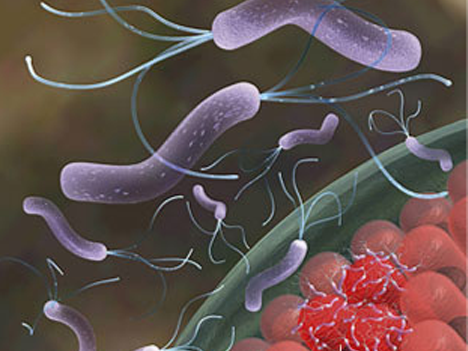 Nghệ vàng, kháng khuẩn, vi khuẩn, H.pylori, tinh bột nghệ, bột nghệ, nghe vang, tinh bot nghe, bot nghe