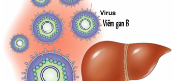 Viêm gan B, triệu chứng và cách phòng ngừa với tinh bột nghệ vàng