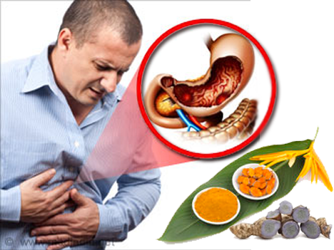 Nghệ đen, nghệ vàng, đau dạ dày, tinh bột nghệ, bột nghệ, nghe vang, nghe den, dau da day, bệnh đau dạ dày, benh dau da day, tinh bot nghe, bot nghe, 