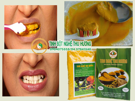 Cách làm trắng răng, làm trắng răng, tinh bột nghệ, nghệ vàng, kem tinh bột nghệ, bột nghệ, tinh bot nghe, bot nghe, nghe vang, cach lam trang rang