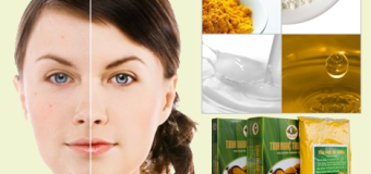 Trị nám da với tinh bột nghệ vàng và các nguyên liệu có sẵn