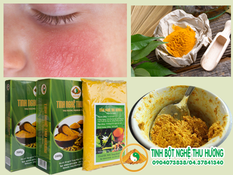 Viêm da dị ứng, dị ứng, nghệ vàng, tinh bột nghệ, tinh bột nghệ vàng, tinh bot nghe, viem da di ung, bột nghệ, bot nghe, nghe vang