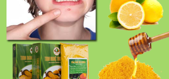 Cách trị mụn bọc bằng tinh bột nghệ vàng hiệu quả