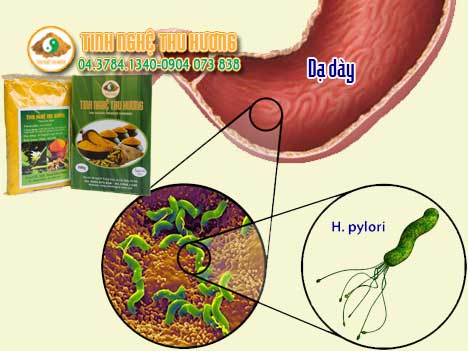 Vi khuẩn, H. Pylori, Helicobacter pylori, dạ dày, ung thư dạ dày, vi khuẩn H. Pylori, nghệ vàng, ung thư, tinh bột nghệ, bột nghệ, nghe vang, bot nghe, tinh bot nghe,