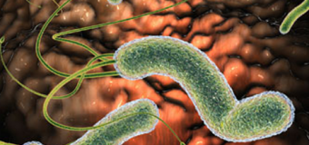 Vi khuẩn H.pylori gây đau dạ dày và tác dụng của nghệ vàng diệt HP [P1]