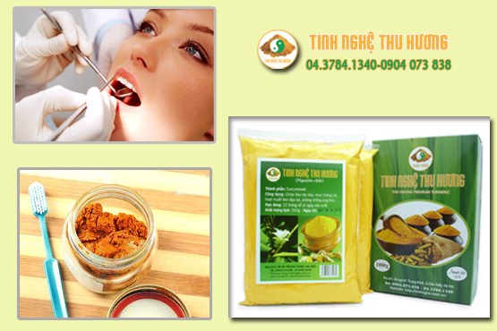 Viêm lợi, viêm nha chu, tinh bột nghệ, Curcumin