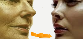 Tinh bột nghệ vàng- thực phẩm chống lão hóa tuyệt vời