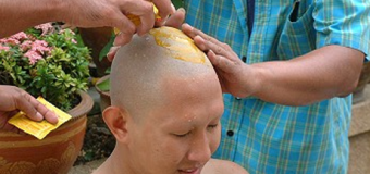 Tinh bột nghệ vàng và 28 lợi ích tốt nhất đối với làn da, mái tóc và sức khỏe [Phần 3]