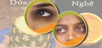 Mắt thâm quầng và liệu pháp trị quầng thâm bằng tinh bột nghệ vàng